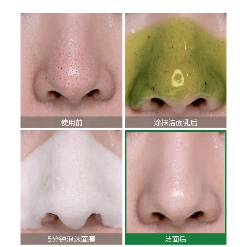 SOME BY MI Bye Bye Blackhead 3 - Skincare Some By Mi avis et prix